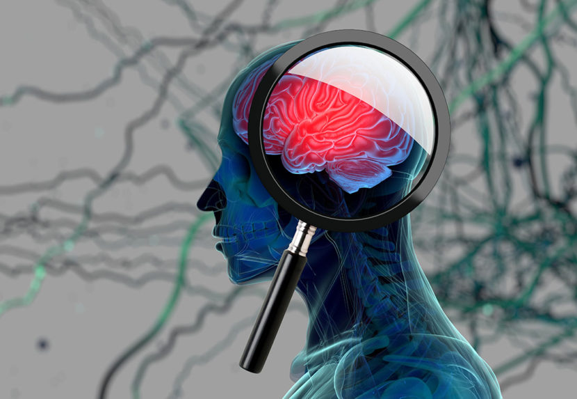 3-D scan of a person's brain with magnifying glass